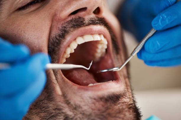 Best Emergency Denture Repair in Huntington Bay, NY